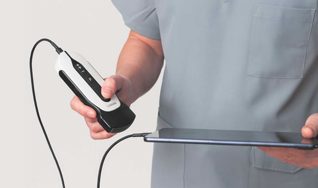 Chison Sonoeye portátil
