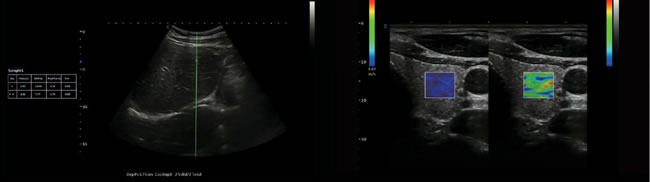 Ultrassom Chison Xbit 80