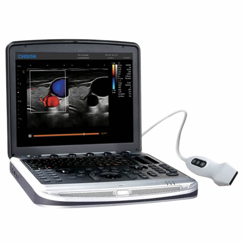 Ultrassom Chison SonoBoot 7