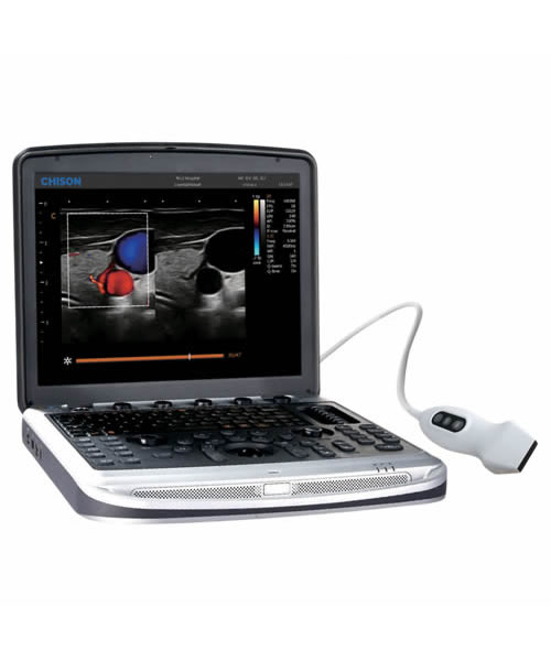 Ultrassom Chison SonoBook 7